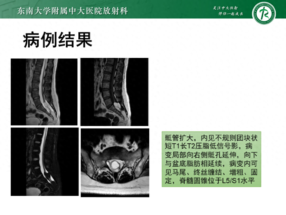 ChatGPT:人工智能助手的medicaljourney