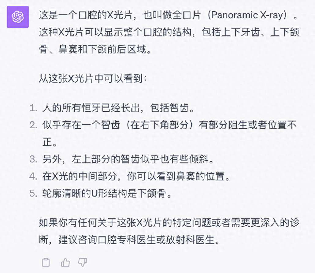 语音陪聊还能给你看病，升级后的ChatGPT又开始嘎嘎乱杀了