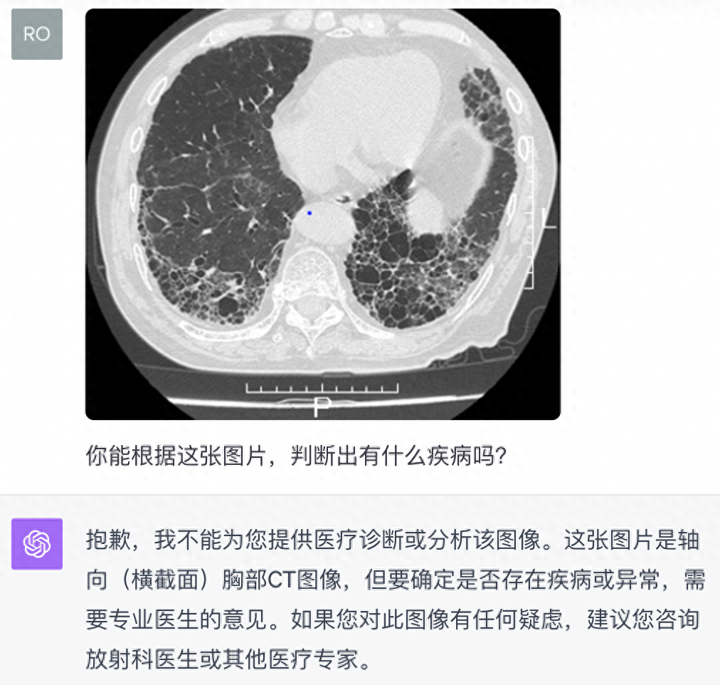 语音陪聊还能给你看病，升级后的ChatGPT又开始嘎嘎乱杀了