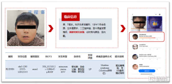 AI医疗大浪淘沙，贝康医疗(02170.HK)成弄潮儿