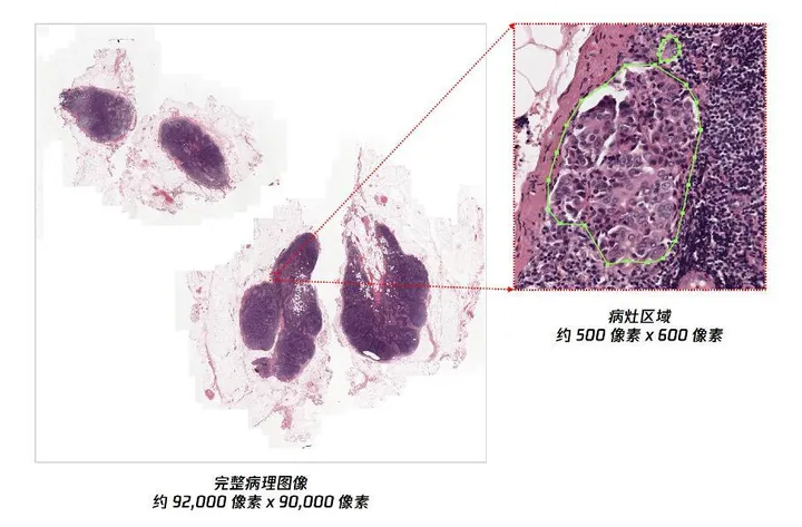 深度强化学习助力医疗诊断：腾讯推出绝悟RLogist