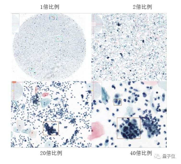 揭秘AI医疗剑谱：五大应用解析，从图像分割到救命时刻的实战之路